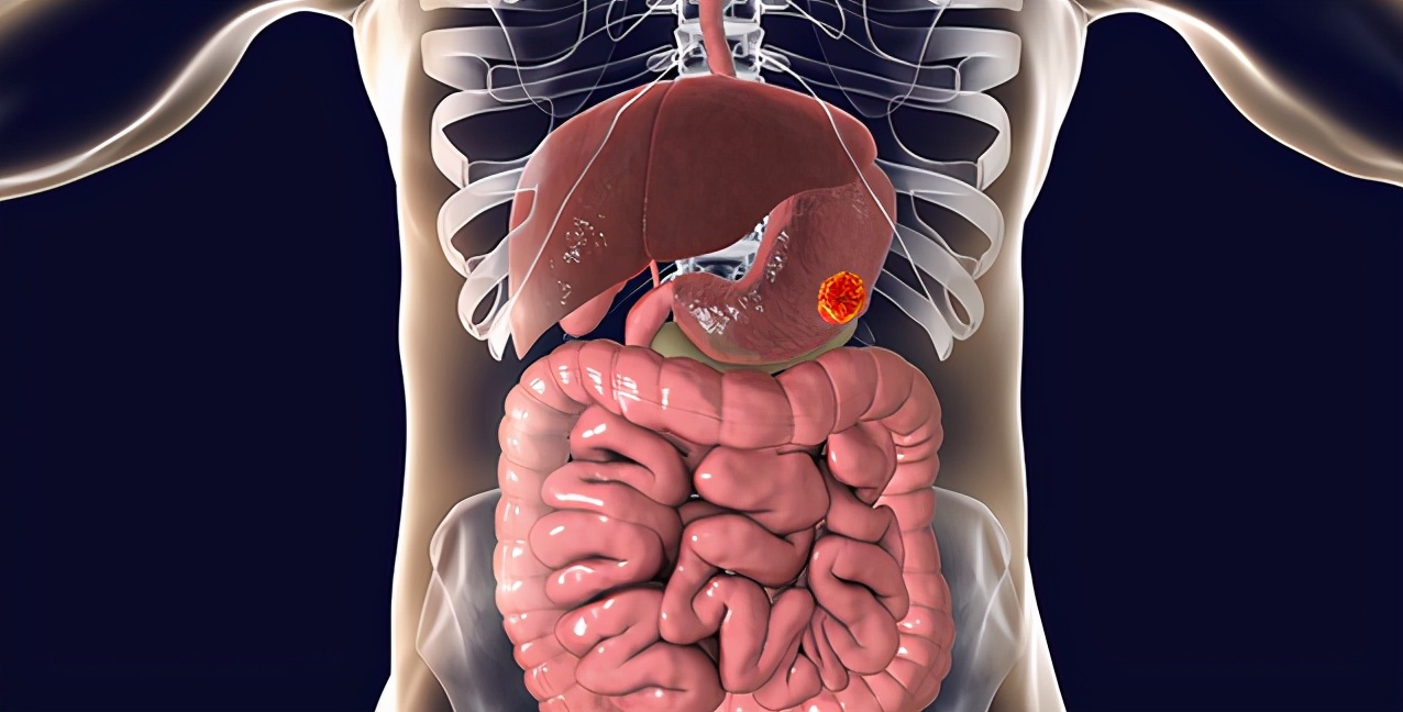 胃溃疡怎么吃醪糟,胃溃疡怎么吃豆腐