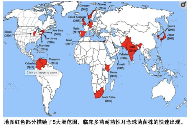 闻臭袜子会感染病毒吗,经常闻臭袜子会引起真菌感染吗