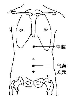 灸法医鉴pdf完整版下载,灸法医鉴