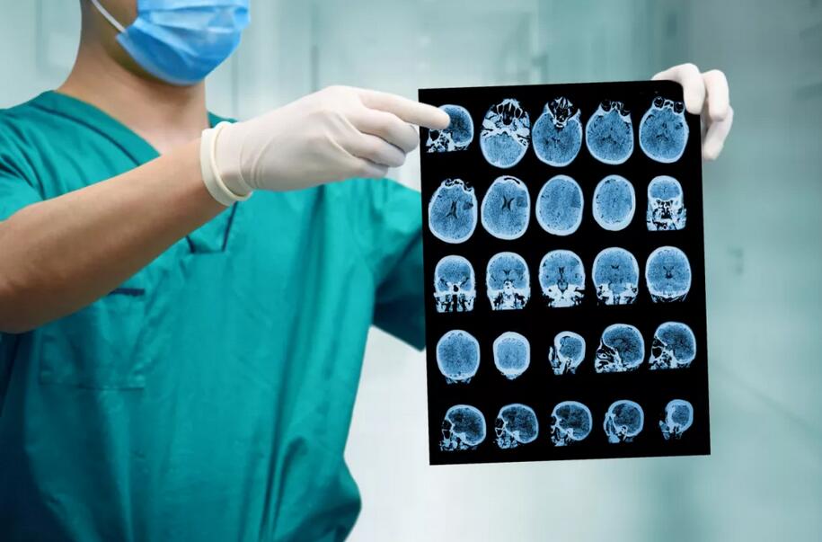 脑卒中血管介入,郑州市脑血管介入治疗专家