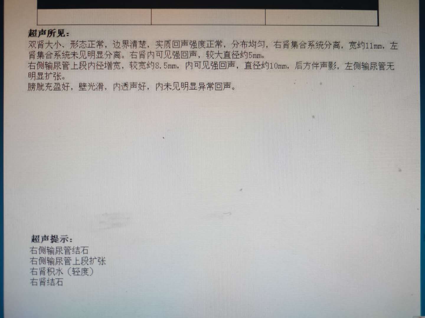 腰疼和肚子疼一般是什么结石,肚子疼腰疼结石怎么缓解