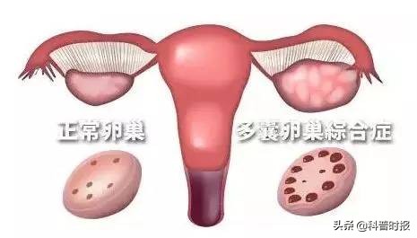 科普卵巢功能的重要性,科普时报官网