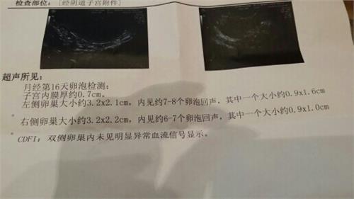 67岁得了子宫内膜癌,60多岁子宫内膜癌有死的吗