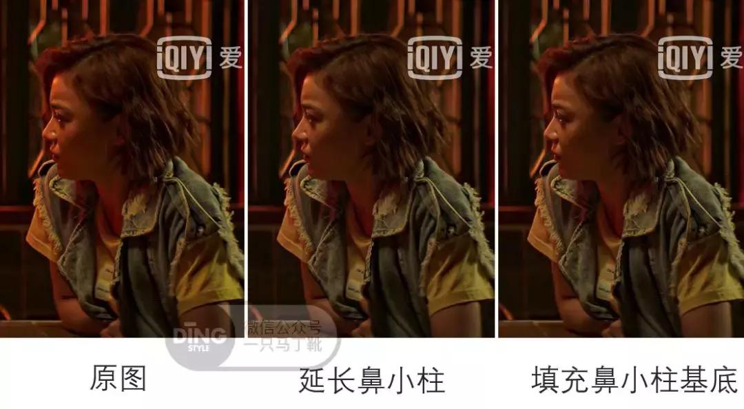 凹面型侧脸怎么改善,凹面型侧脸是怎么造成的