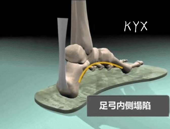 中老年人脚底痛是什么原因,老人脚底板好疼是什么原因