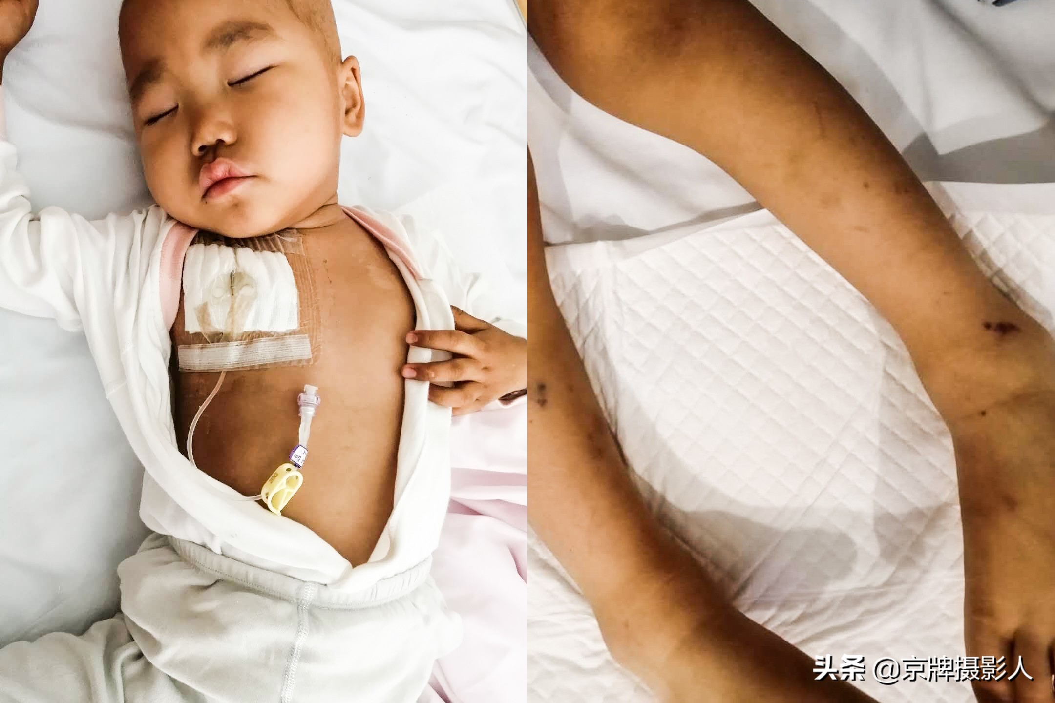 21岁姑娘怀孕被婆婆逼着引产,女子怀孕七个月被老公逼引产