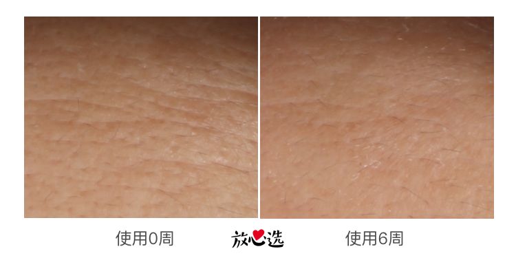 雅诗兰黛最新评测,雅诗兰黛精华测评连续剧