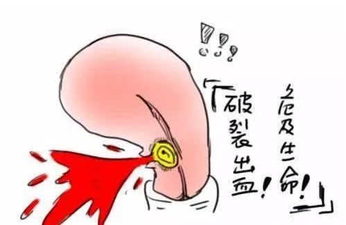 剖腹产后瘢痕妊娠的概率,腹膜外剖腹产容易瘢痕妊娠吗