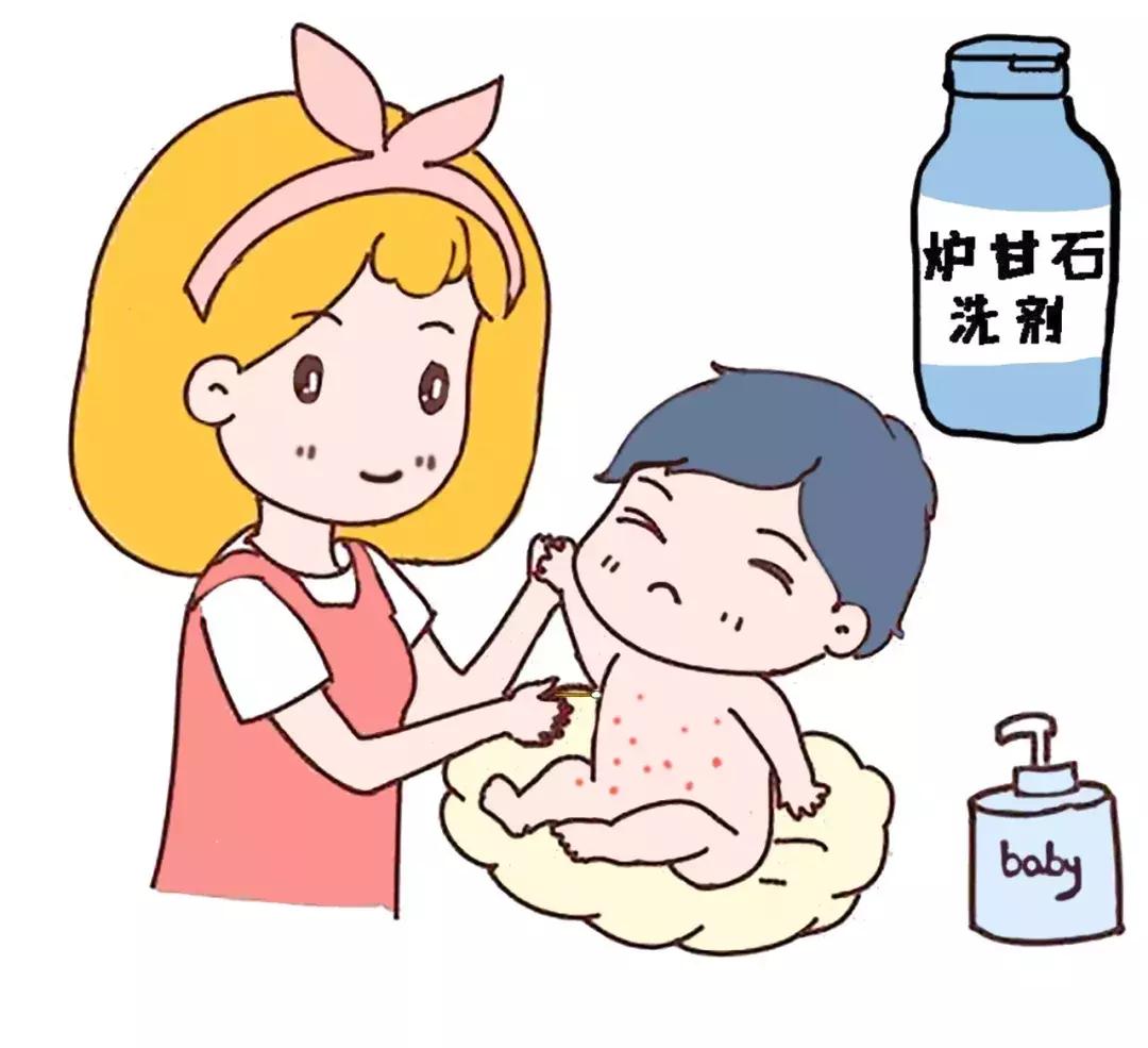 痱子反反复复偏方,中医痱子怎么消除