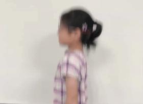 如何选择搭配镜框的镜片,高度数的镜片适合什么镜框