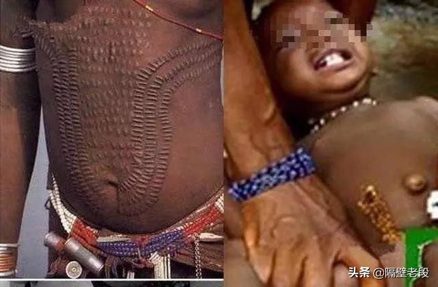 熨平少女胸部!揭秘非洲可怕习俗“烫乳”