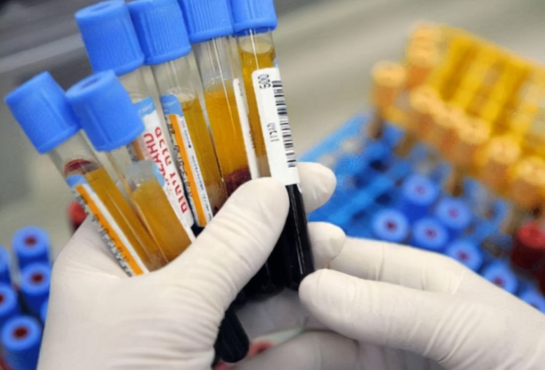 血常规检查各项指标都高什么原因,血常规检查3项高有什么病