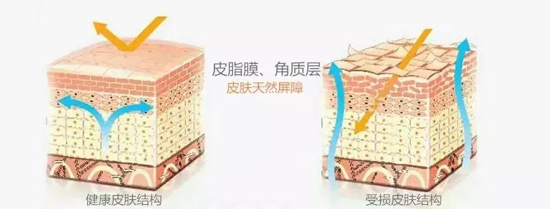 眼皮一抹护肤品就有刺痛感怎么办,刷酸后为什么用护肤品有刺痛感呢