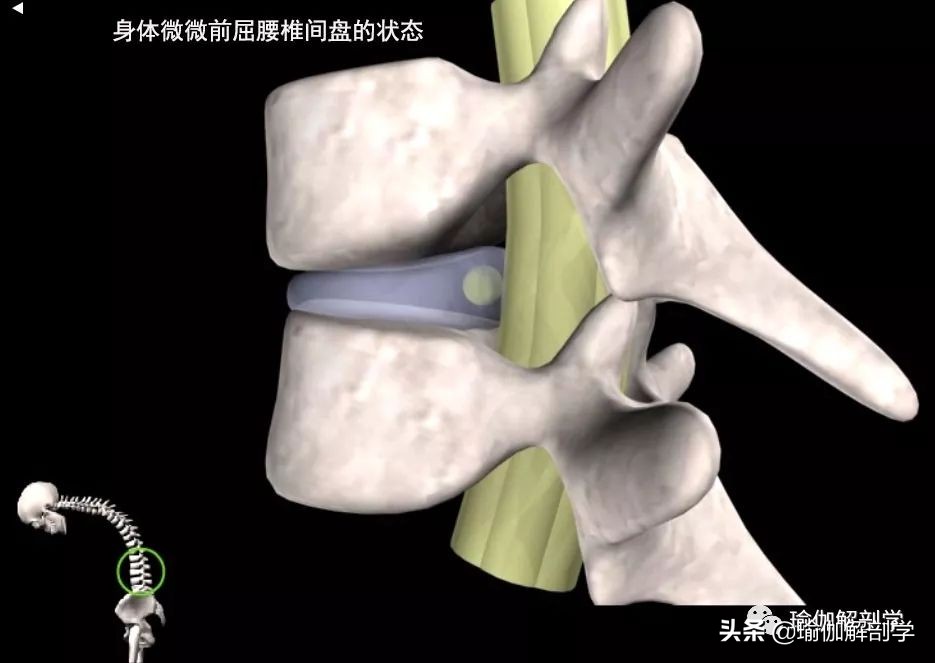 腰椎间盘突出适合练瑜伽哪些动作,腰椎间盘突出做什么瑜伽可以恢复