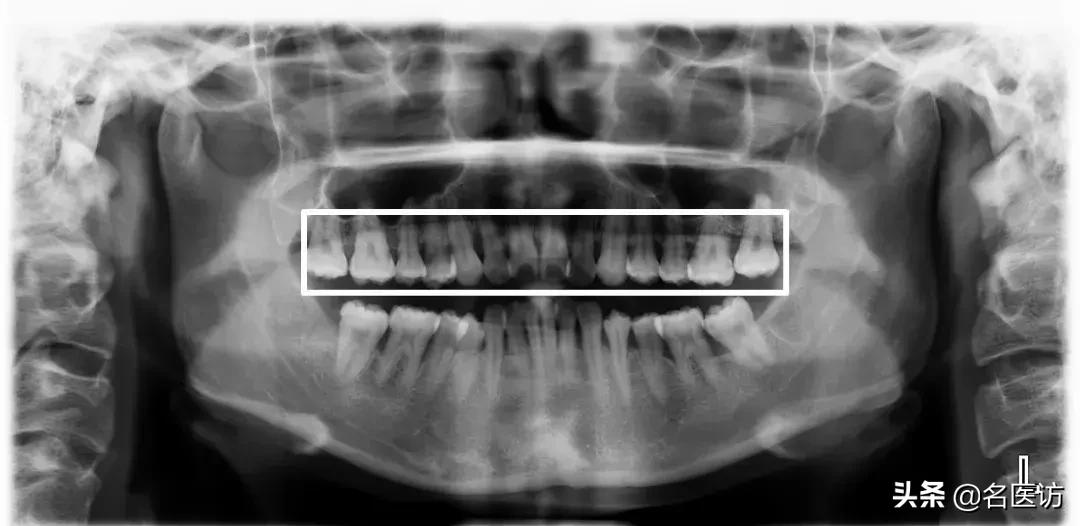 矫正牙科普馆,矫正牙齿科普知识