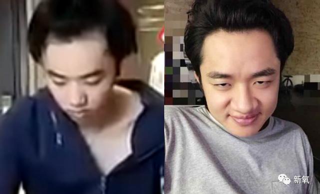 华晨宇整前整后对比,华晨宇最近又整脸了么
