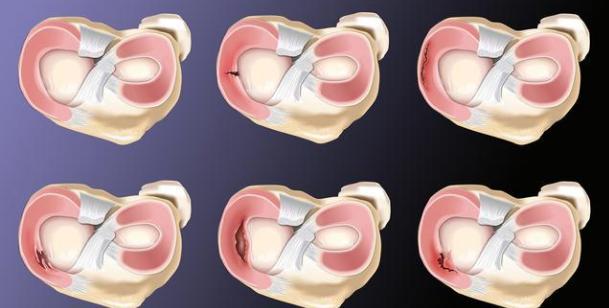 跑完步膝盖疼是怎么回事如何缓解,跑完步后膝盖痛应该怎么解决