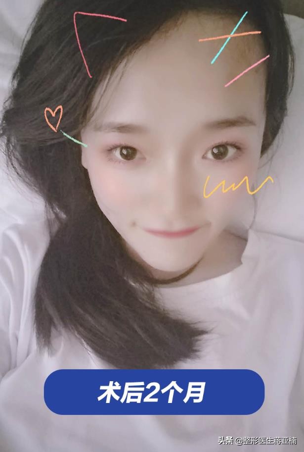 青春期如何不长痘还变美,青春不留痘原版视频