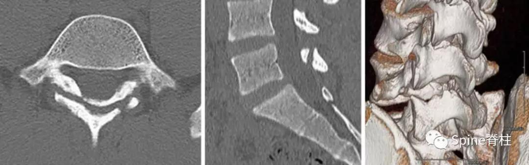 青少年一跑步就腰痛,青少年腰痛是什么原因引起的