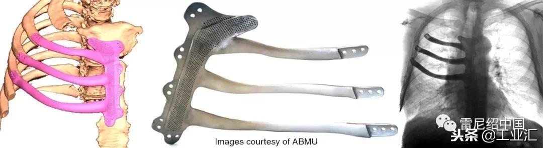 癌症患者一年不复发,癌症患者出现回光返照还能活多久