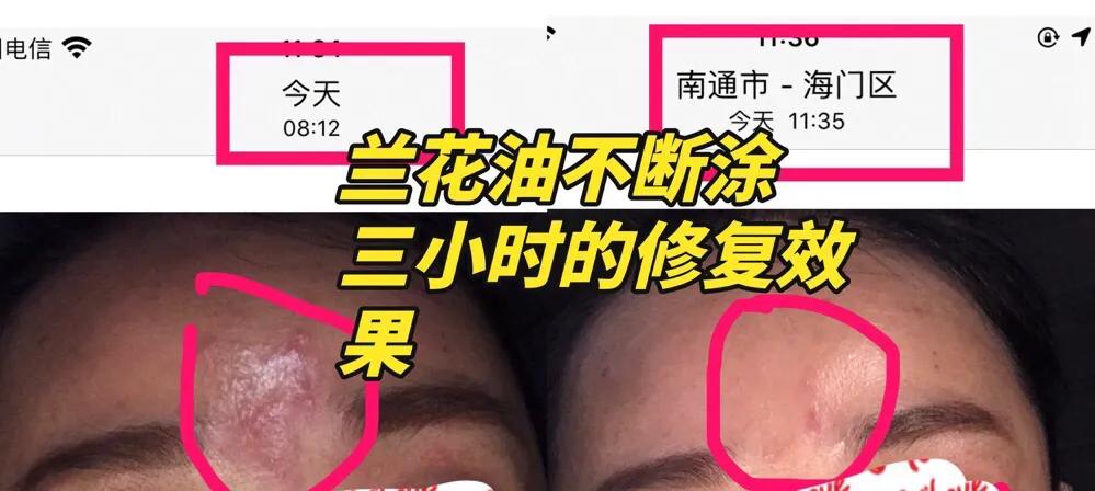 精华油天花板,精华液天花板