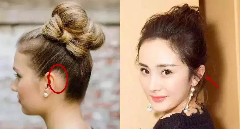 颅顶太低如何自救,颅顶低怎么自救