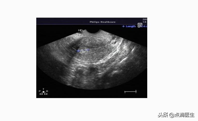 排卵后怎么判断怀孕,怎样判断是否排卵的方法