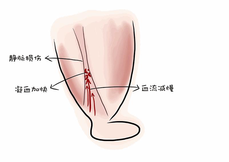 【慎之又肾】经常自我感觉“膨胀”？你可能是肿了
