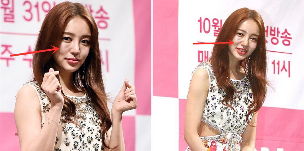 「印第安纹」*伤杀**力多大？让少女秒变大妈