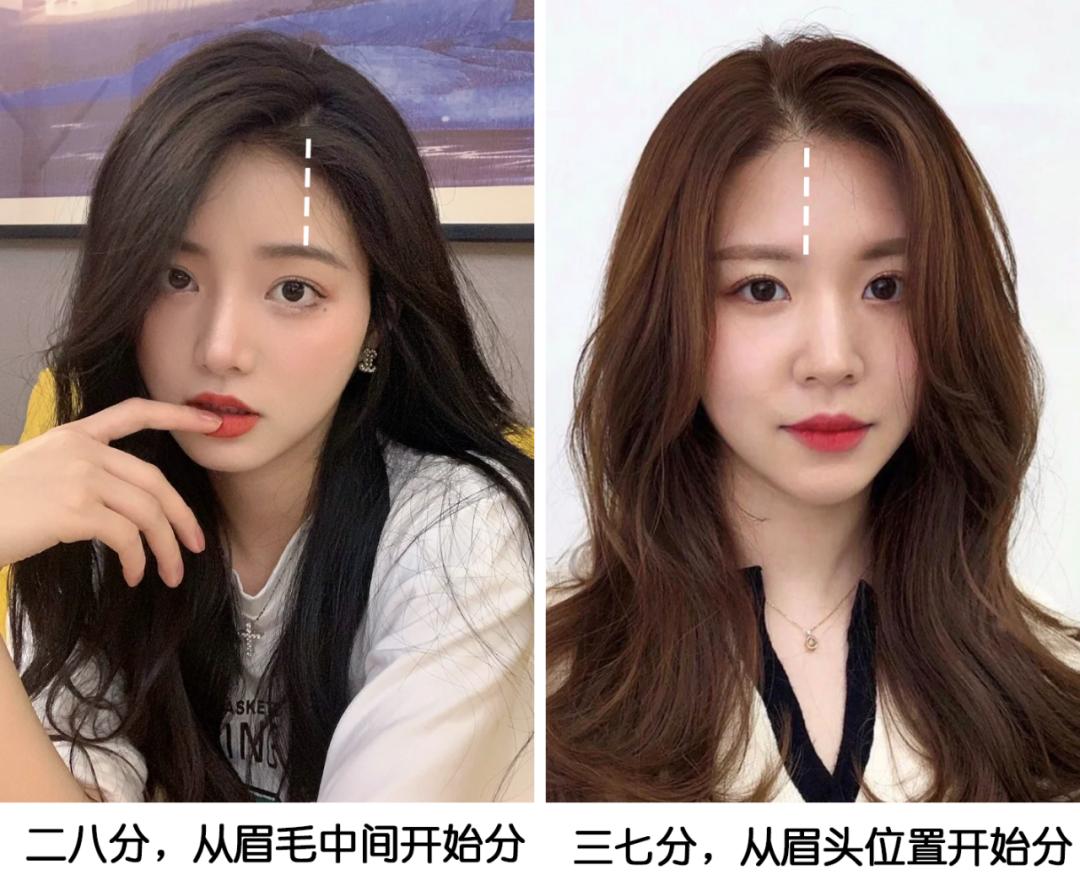 颅顶高了但发际线高怎么办,颅顶低的几种补救办法