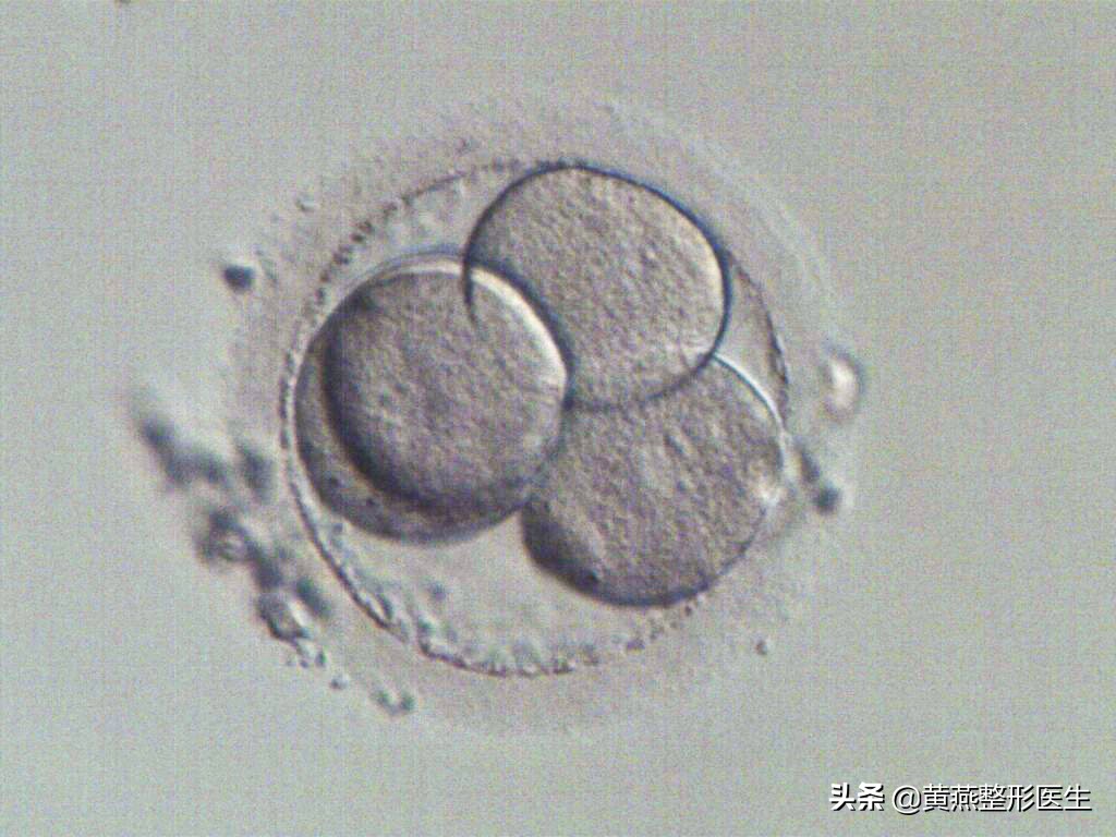 为了小孩子有个伴，大龄的她选择做试管婴儿