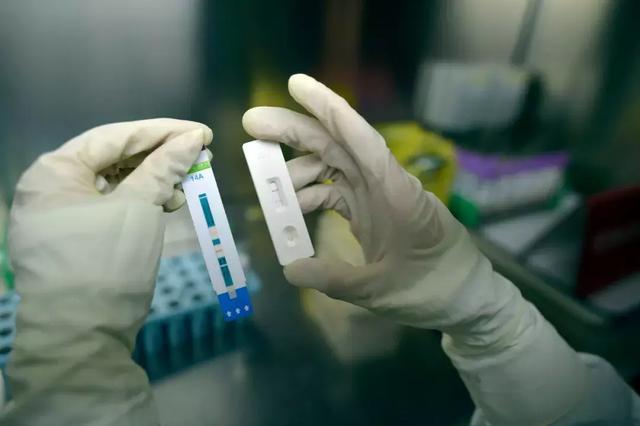 艾滋试纸大药房有卖吗,网上购买的艾滋病试纸准确检测