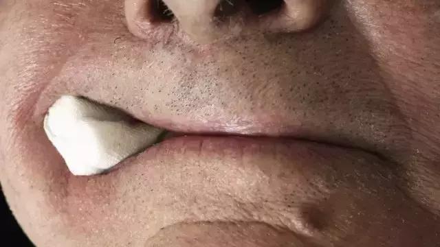 拔牙打麻药是用针扎还是抹上去,拔牙打麻药对脑神经有影响吗