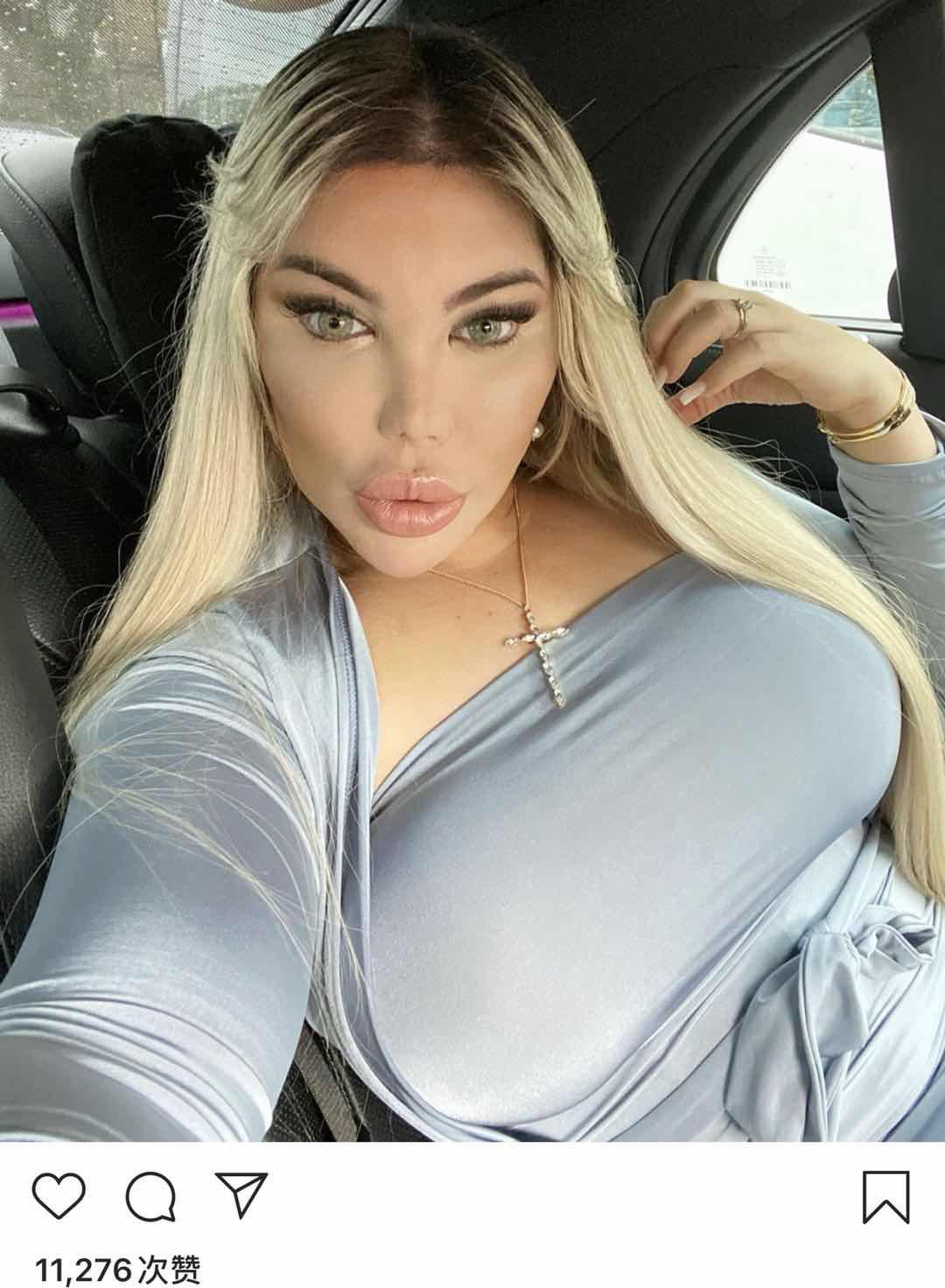 巴西男整容42次图片,巴西男模花数百万整容