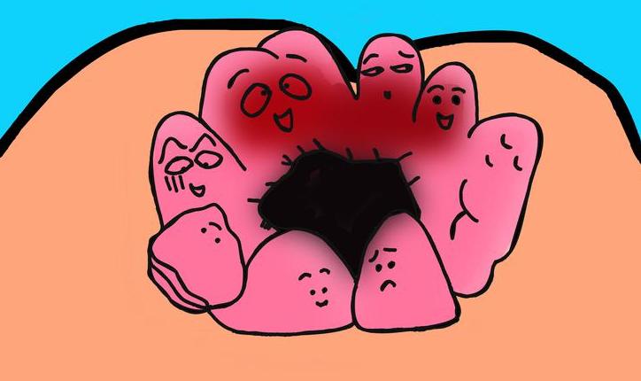 发现痔疮越长越多这到底是咋回事,突然发现长了个痔疮怎么办