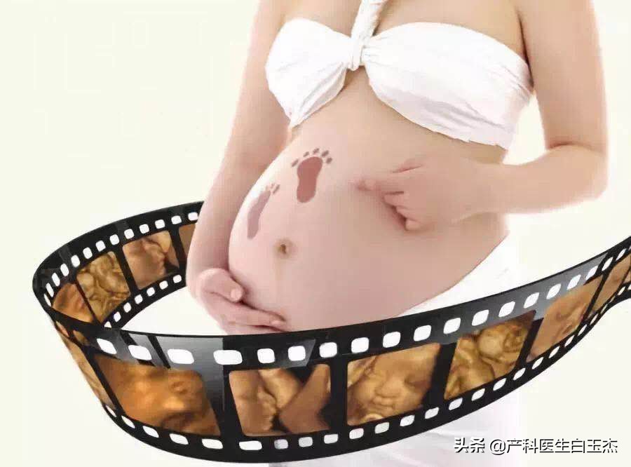 做四维彩超能看到胎儿图片吗,四维彩超图片就是胎儿的样子吗