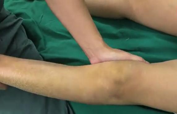 跑步爬楼梯腿会变粗嘛,爬山跑步会磨没软骨吗