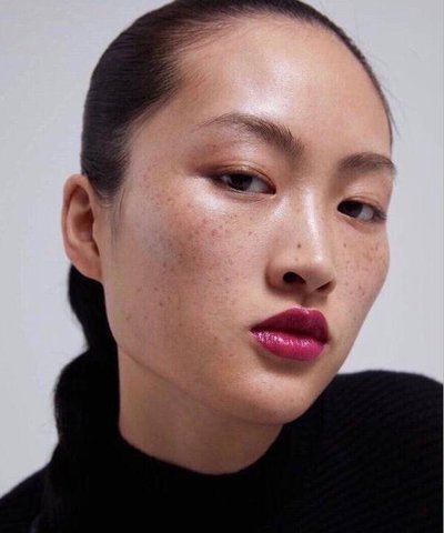 雀斑祛斑最简单有效方法,雀斑祛斑最有效方法真实测评