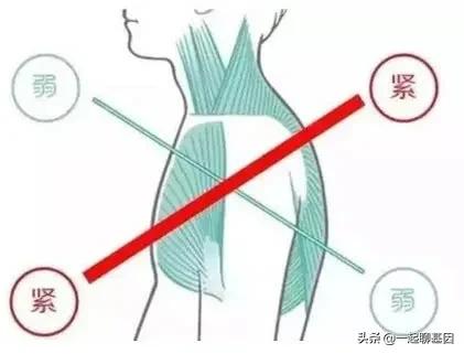 驼背怎么办最有效的方法,驼背怎么矫正最有效方法