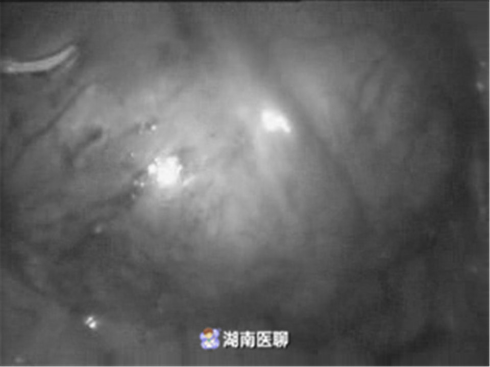 女性备孕3个月没怀上,备孕很久都没怀上的女人怎么了