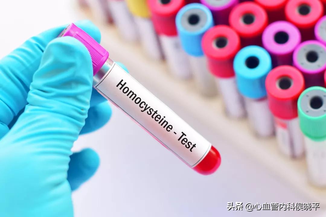 h型高血压补充叶酸最佳剂量,有高血压的人能吃叶酸吗