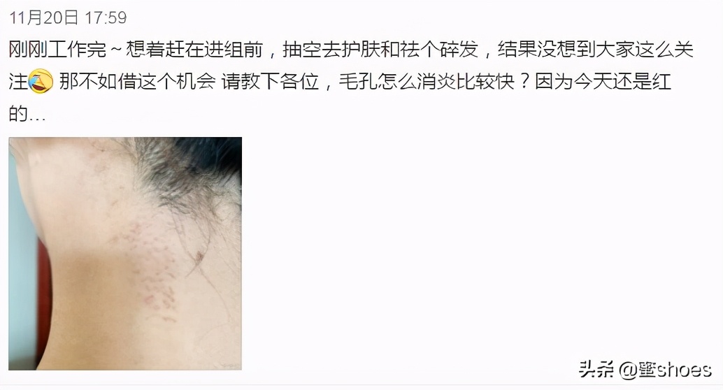 4个让你变美的脸部动作,教你4个变美动作