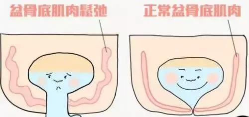 孕期耻骨分离痛是什么原因,孕期一侧耻骨疼怎么缓解