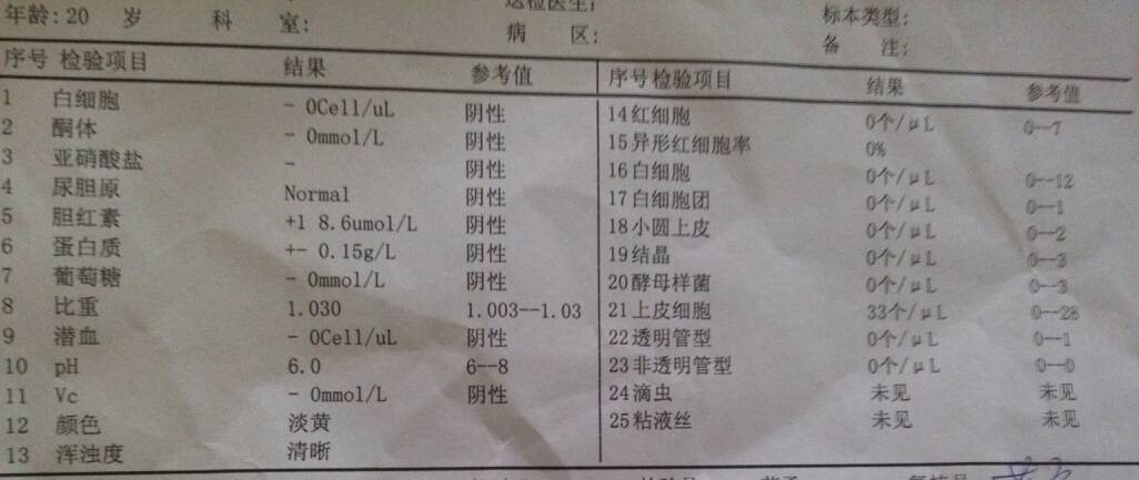 晨起尿黄和肝有关系吗,入职体检尿胆红素阳性是怎么回事