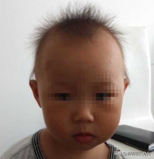 宝宝头发问题,宝宝头发少头发黄怎么办