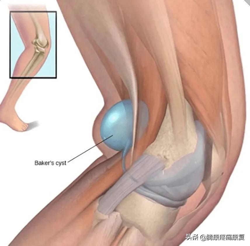老人小腿疼痛是什么原因,脚小腿肌肉疼痛是什么原因