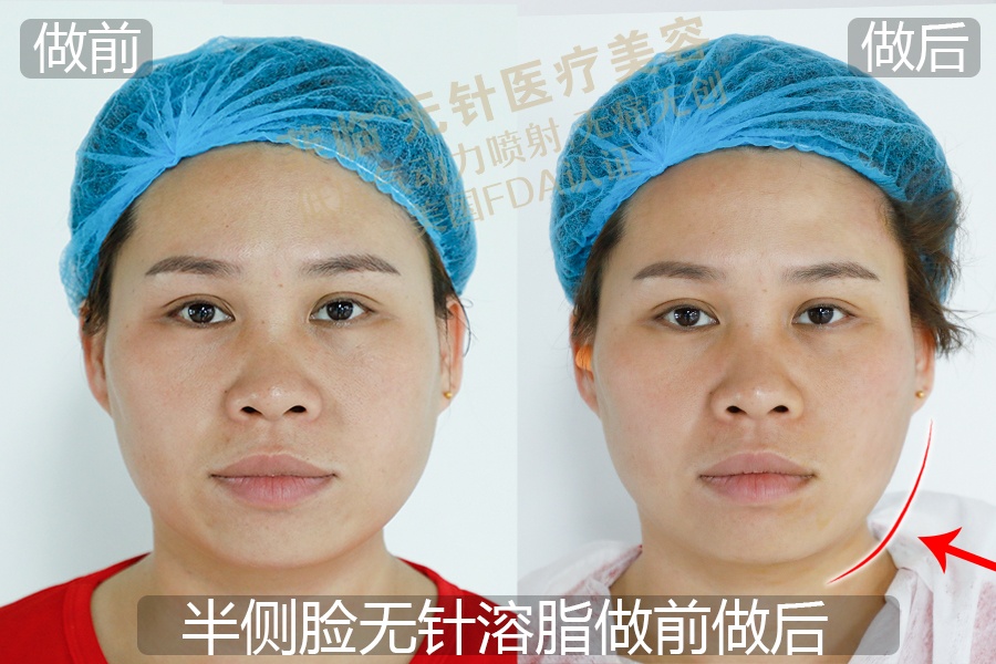 逆天侧颜女,逆天绝世容颜