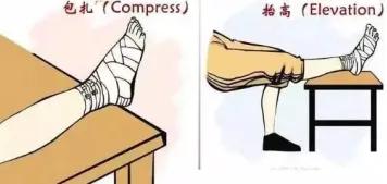 轻度崴脚未肿的正确处理办法,崴脚了可以自己修复