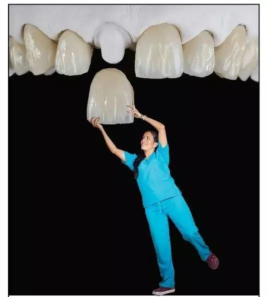 三甲医院全瓷牙保质期,全瓷牙有缝隙保质期是多久