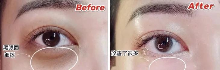 百年老牌马应龙又放大招，把眼纹收拾得服服帖帖，没有年龄感